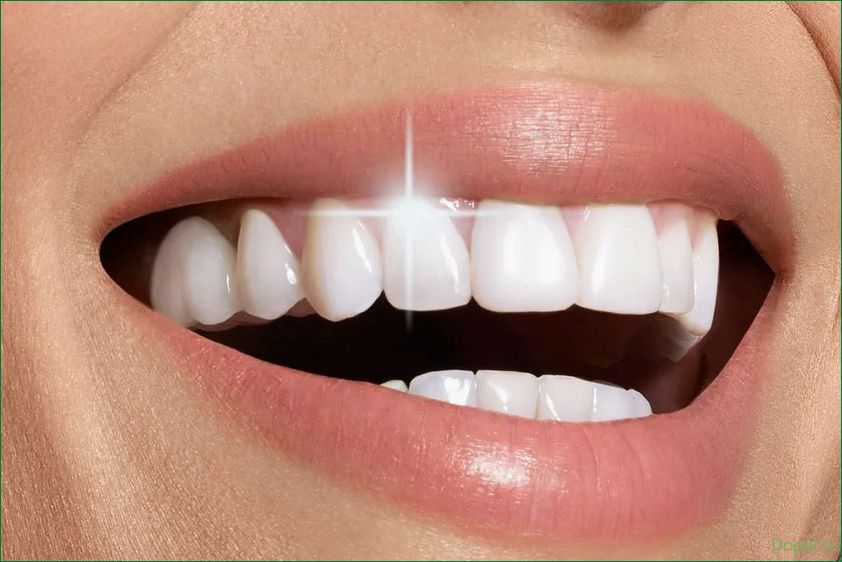 Отбеливание зубов Zoom 4 — эффективный и безопасный способ получения белоснежной улыбки